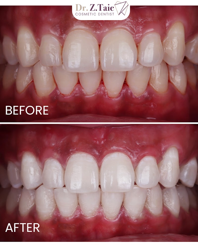 Dentist Z Taie (Dubai - Marina) - dental clinic in Dubai Marina