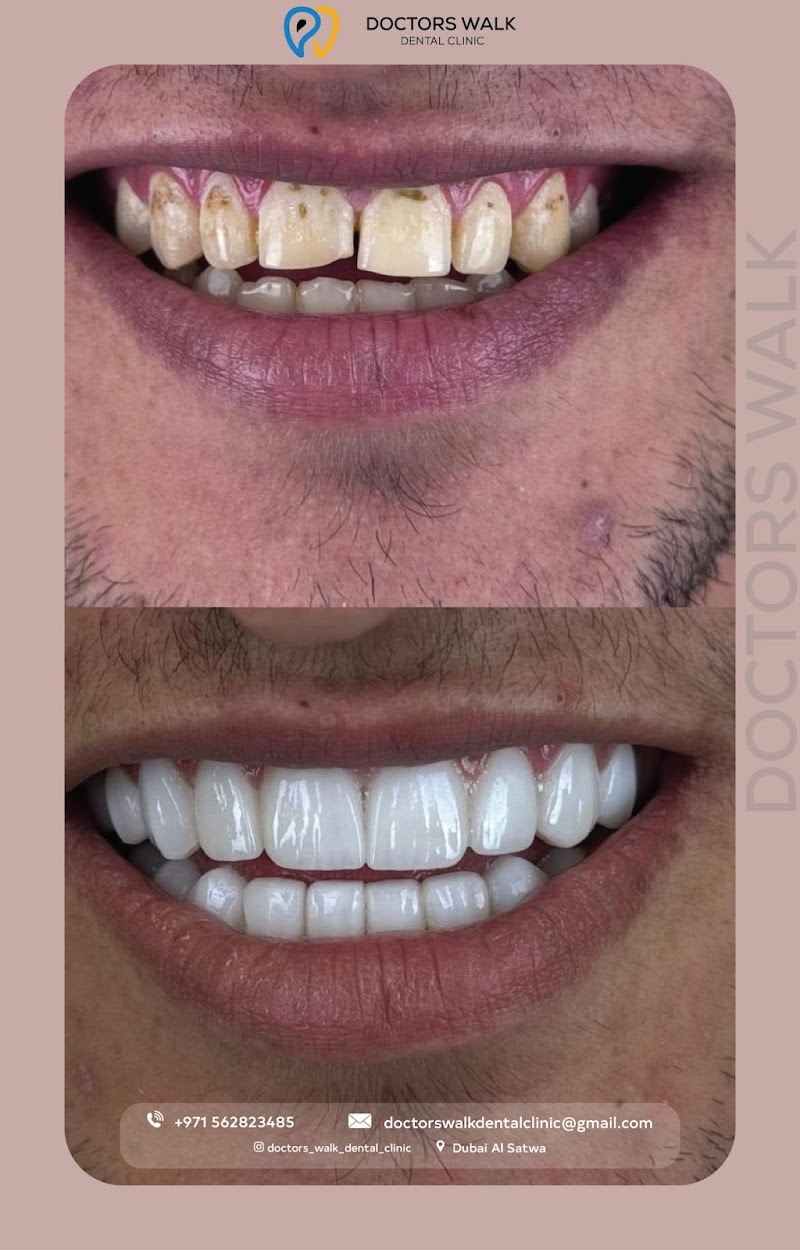 Doctors Walk Dental Clinic - dental clinic in Al Satwa