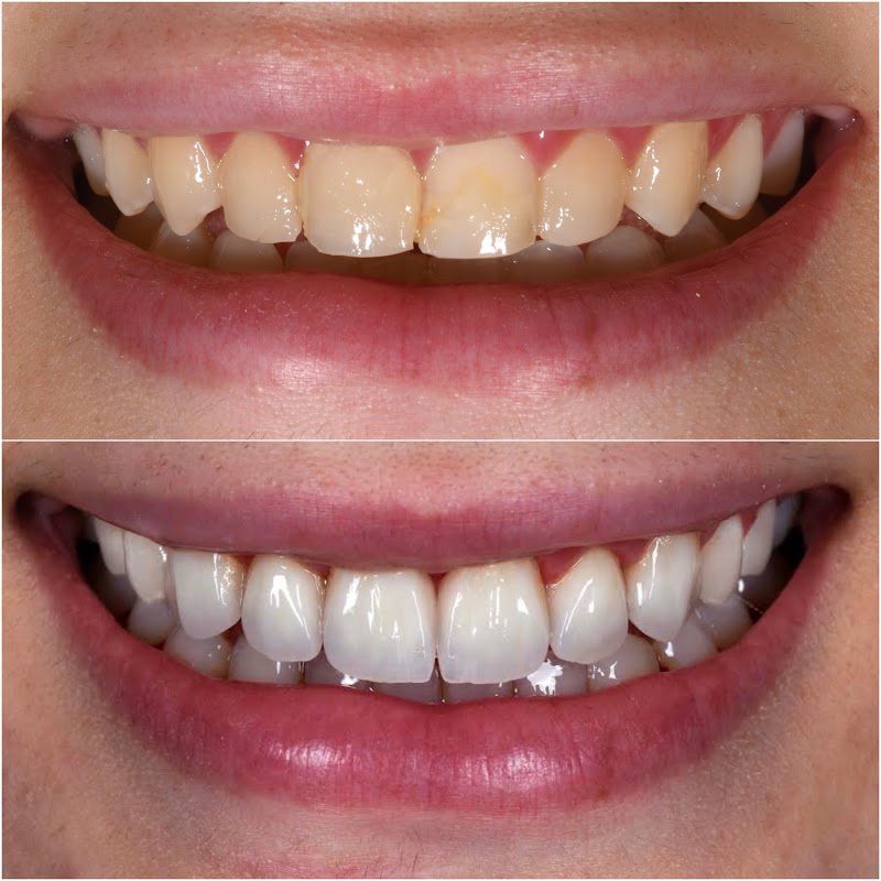 Dr. Ahmed Nassiri - Specialist Prosthodontist & Cosmetic Dentist - dental clinic in Jumeirah Village Circle