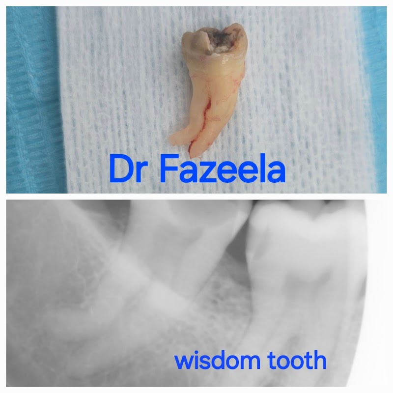 Dr. Fazeela Yoosuf - dental clinic in Al Twar 4