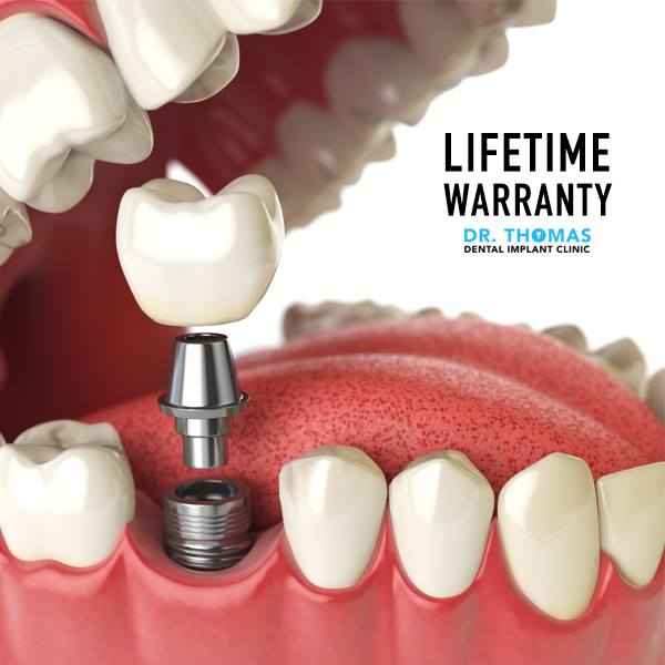 Dr. Thomas Dental Implant Clinic - dental clinic in Jumeirah Lakes Towers