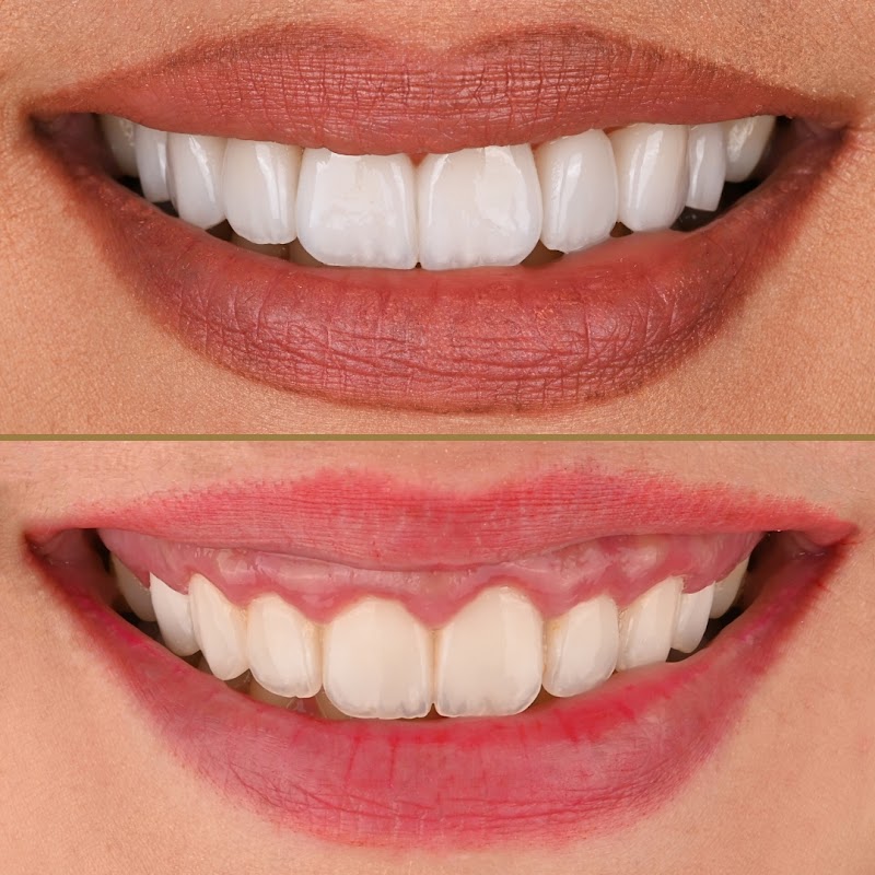 MyoSmile Polyclinic - Dental Clinic in Jumeirah - dental clinic in Jumeirah 1