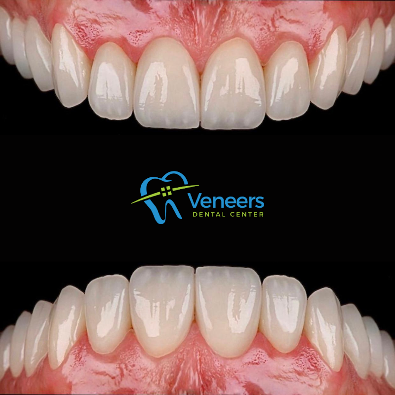 Veneers Dental Centre - dental clinic in ديرة