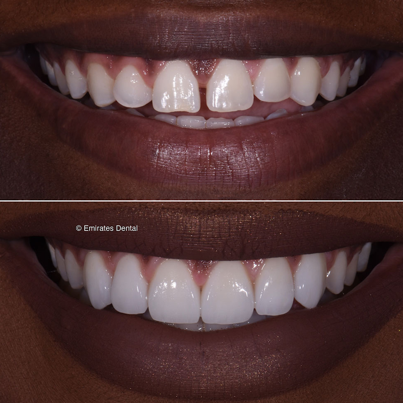 Emirates Dental Clinic